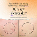 Derma E Acne Deep Pore Cleansing Wash - 175ml - Skin Care