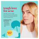 Burt's Bees Natural Acne Solutions Deep Cleansing Scrub - 113.3 g - Skin Care