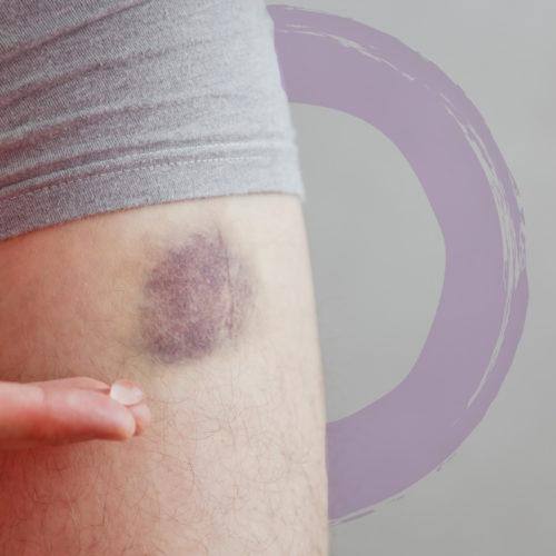 Boiron Arnicare Bruise - 45g - - Skin Care